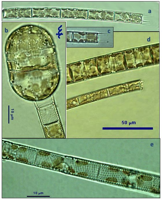 Aulacoseira granulata (Ehrenberg) Simonsen 1979 — plate 1 (from source)