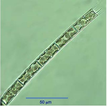 Aulacoseira granulata thumbnail
