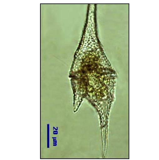 Ceratium furcoides (Levander) Langhans 1925 thumbnail