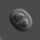 Chroococcus minutus (Kützing) Nägeli 1849 thumbnail