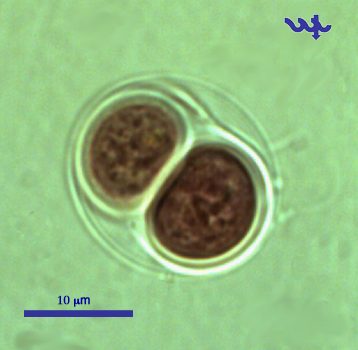Chroococcus turgidus (Kützing) Nägeli 1849 — plate 1 (from source)