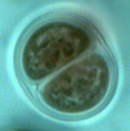 Chroococcus turgidus (Kützing) Nägeli 1849 thumbnail