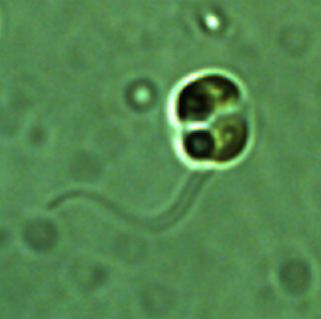 Chrysochromulina parva Lackey 1939 thumbnail