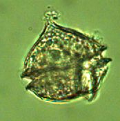Diplopsalis acuta (Apstein) Entz 1906 thumbnail
