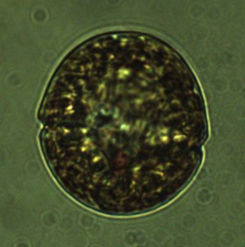 Durinskia oculata (Stein) Gert Hansen et Flaim 2007 thumbnail