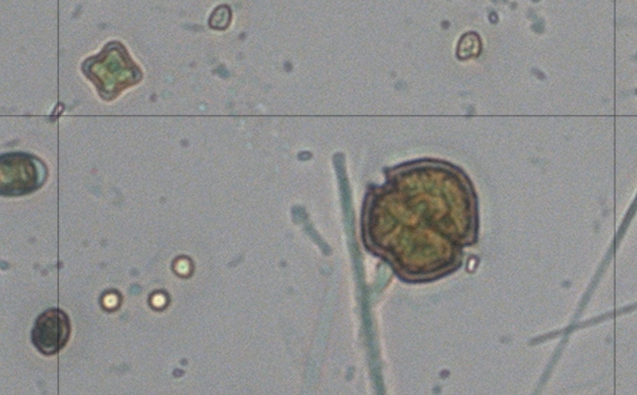 Glochidinium penardiforme (Lemmermann) Boltovskoy 2000 — plate 1 (from source)