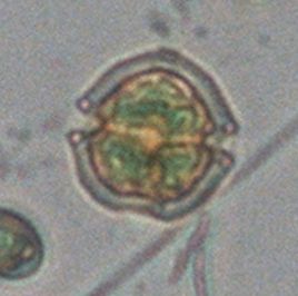 Glochidinium penardiforme (Lemmermann) Boltovskoy 2000 thumbnail