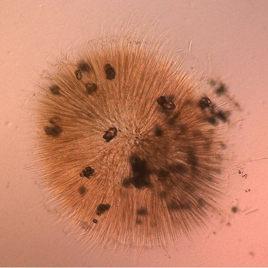 Gloeotrichia pisum Thuret ex Bornet & Flahault 1886 thumbnail