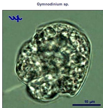 Gymnodinium F. Stein 1878 thumbnail
