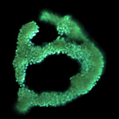 Microcystis aeruginosa thumbnail