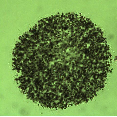 Microcystis flos-aquae thumbnail