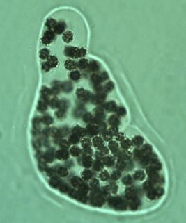Microcystis wesenbergii (Komárek) Komárek ex Komárek 2006 thumbnail