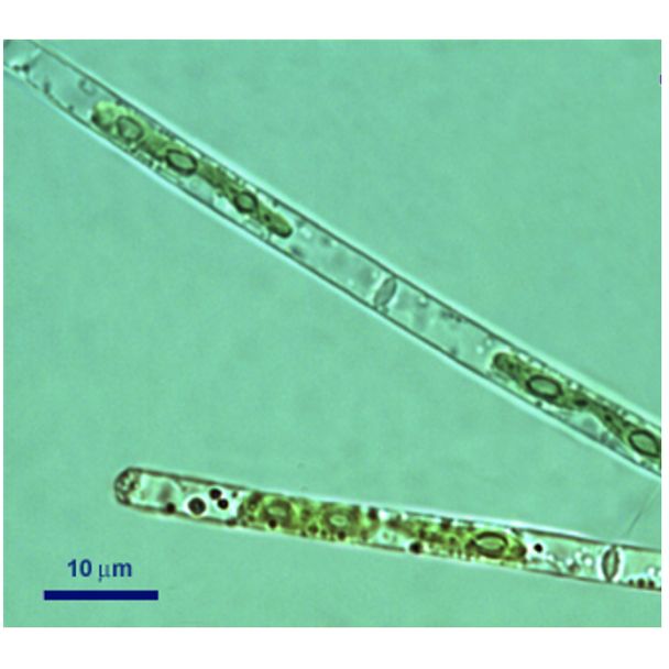 Mougeotia Agardh 1824 thumbnail