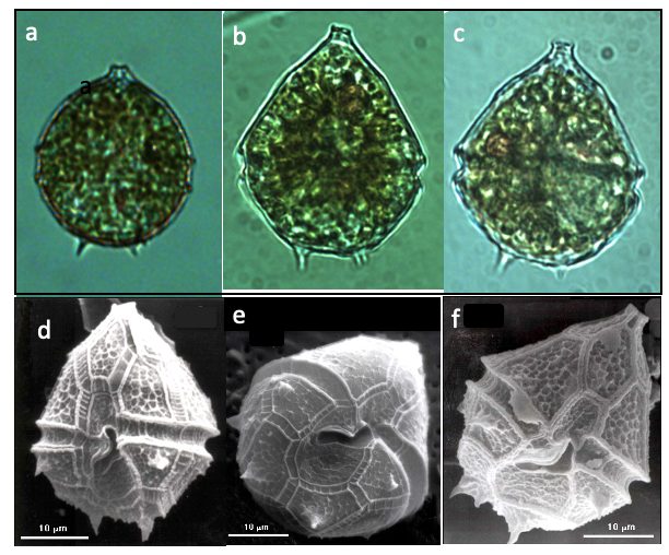 Parvodinium cunningtonii (Lemmermann) Pandeirada et al 2022 — plate 1 (from source)