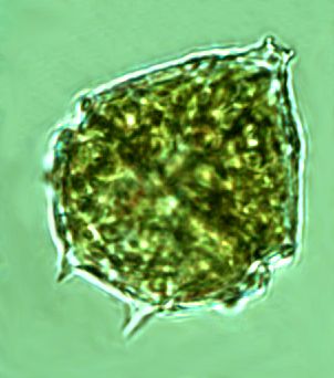 Parvodinium cunningtonii (Lemmermann) Pandeirada et al 2022 thumbnail