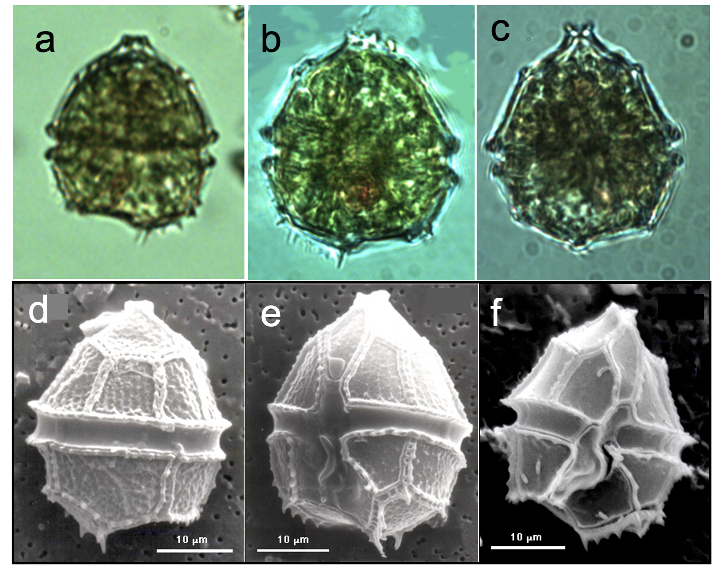 Parvodinium elpatiewskyi Ostenfeld) Kretschmann et al 2019 — plate 1 (from source)