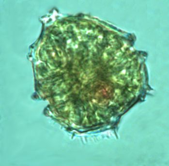 Parvodinium elpatiewskyi (Ostenfeld) Kretschmann et al 2019 thumbnail