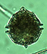 Peridiniopsis borgei Lemmermann 1904 thumbnail