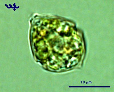 Peridiniopsis cunningtonii var. quinquecuspidata (Massart) Nygaard 1926 thumbnail