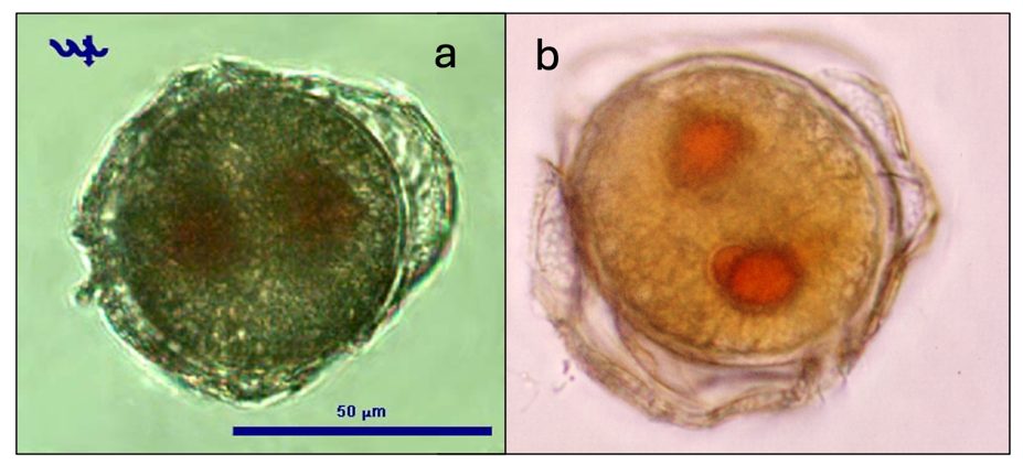 Peridinium gatunense Nygaard 1925 — plate 3 (from source)