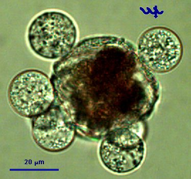 Peridinium gatunense Nygaard 1925 — plate 5 (from source)