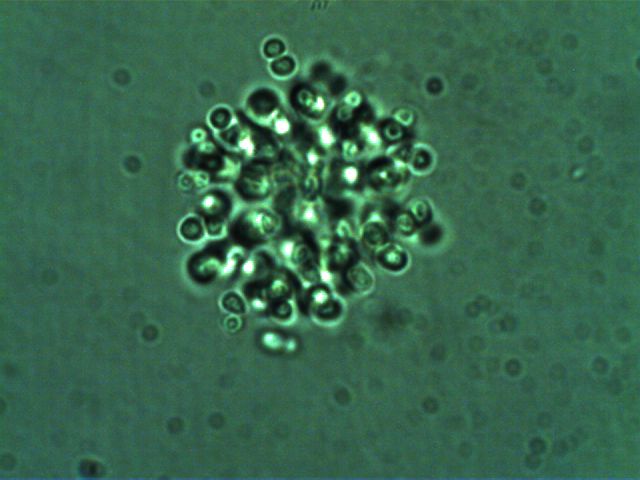 Radiocystis geminata Skuja 1948 thumbnail