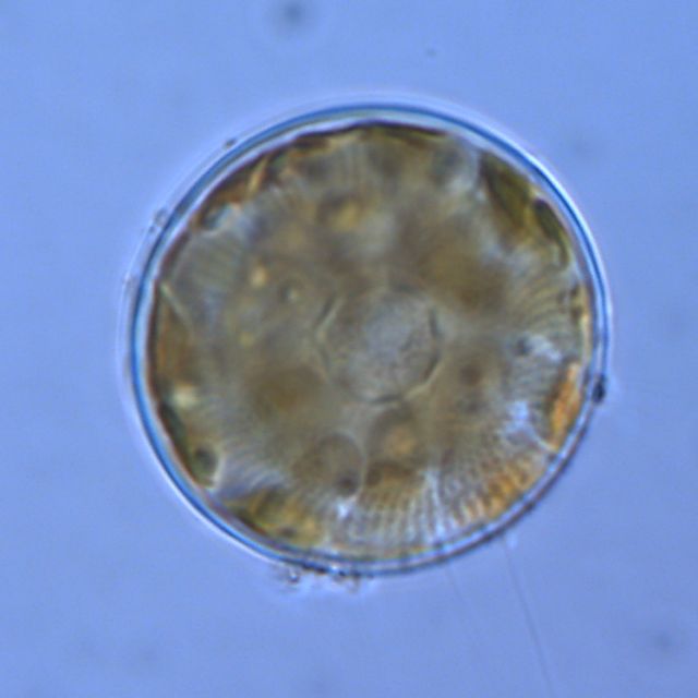 Stephanocyclus meneghinianus thumbnail