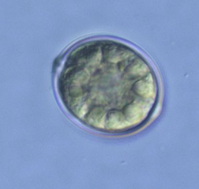 Trachelomonas Ehrenberg 1833 thumbnail